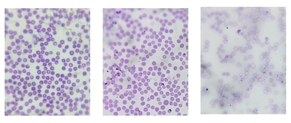 Tick-borne blood parasites in small ruminants: An epidemiological study ...
